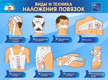 Стенд «Наложение повязок»