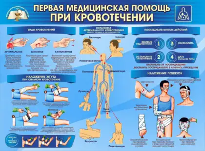 Стенд «Первая помощь при кровотечении»