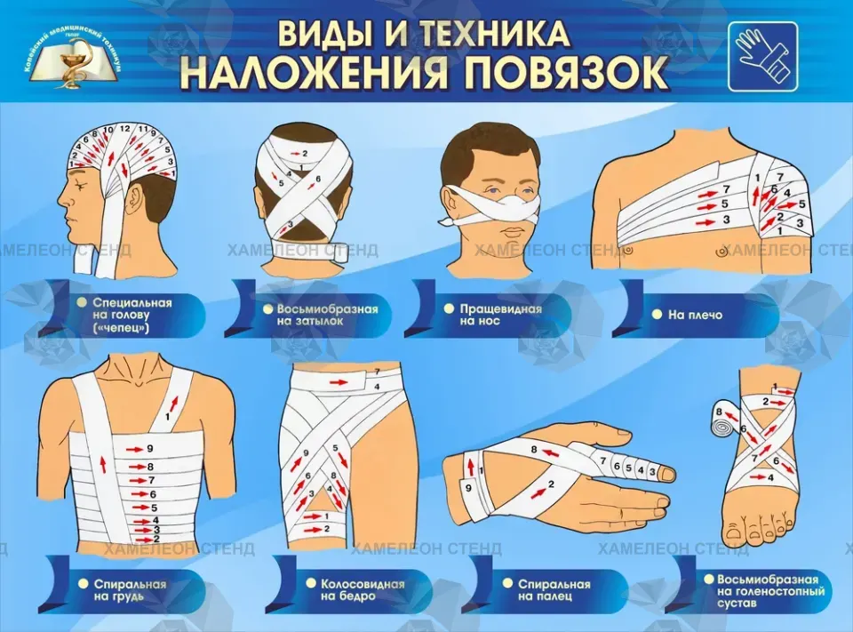 Стенд «Наложение повязок»