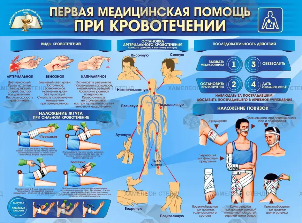 Стенд «Первая помощь при кровотечении»